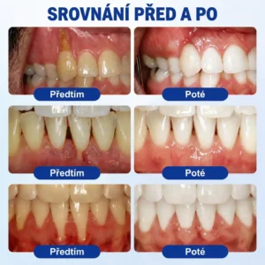 Parodontální Regenerační Gel GumRevive - Image 3