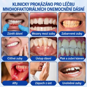 Parodontální Regenerační Gel GumRevive - Image 6