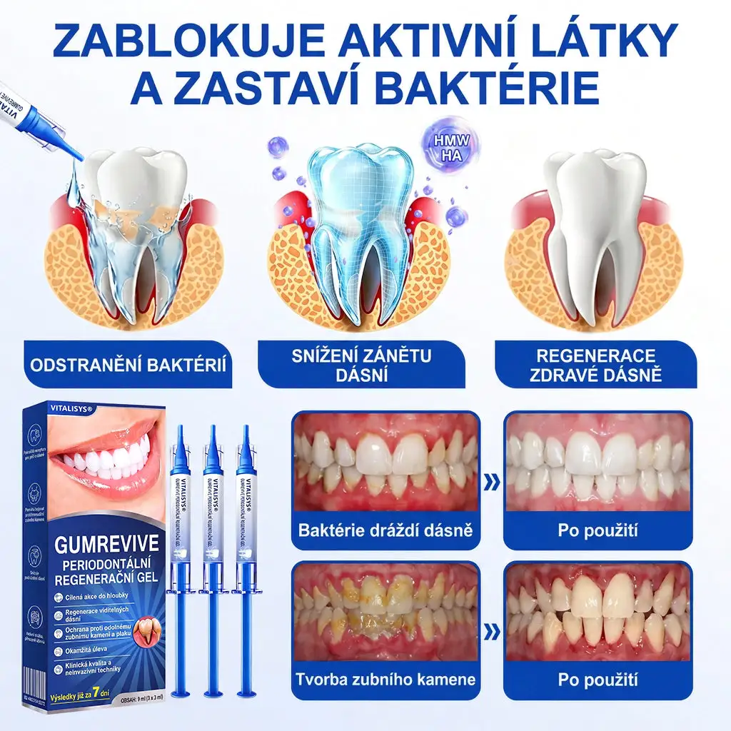 Parodontální Regenerační Gel GumRevive - Image 9
