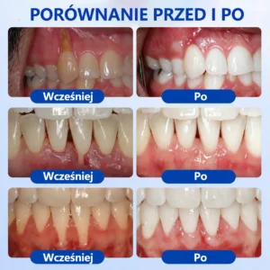 GumRevive - Image 3