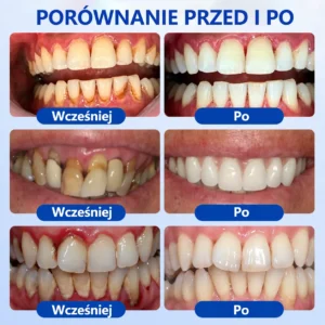GumRevive - Image 4