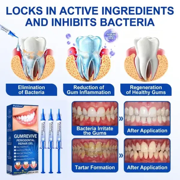 GumRevive Periodontal Repair Gel - Image 8