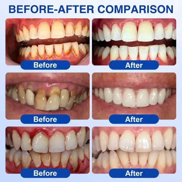 GumRevive Periodontal Repair Gel - Image 15