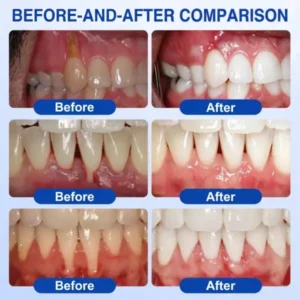 GumRevive Periodontal Repair Gel - Image 16