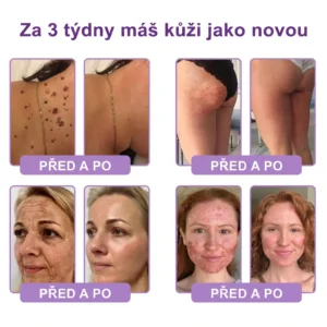 PDRN Multi-Peptide masážní tělový krém s masážním válečkem - Image 5