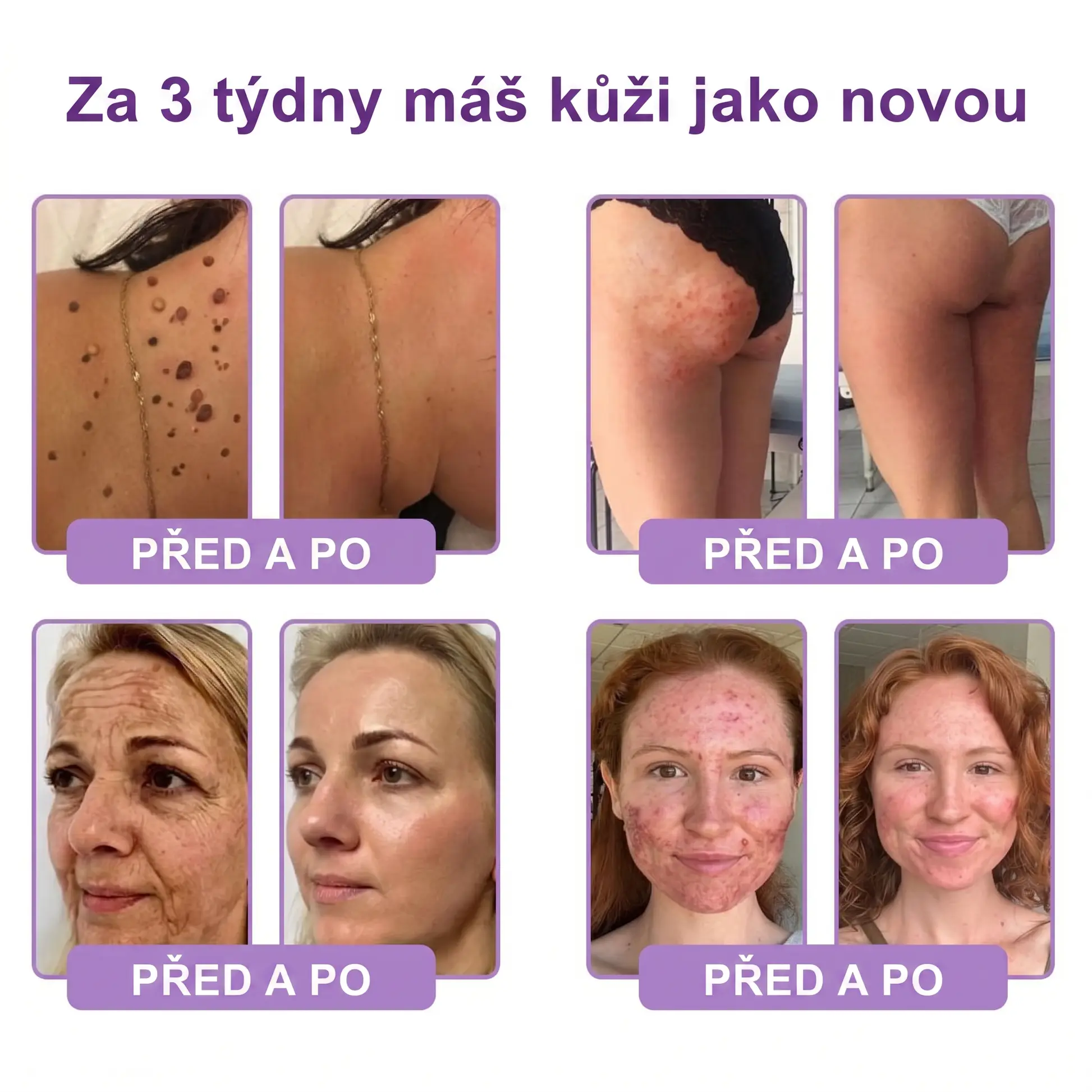 PDRN Multi-Peptide masážní tělový krém s masážním válečkem - Image 5