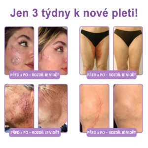 PDRN Multi-Peptide masážní tělový krém s masážním válečkem - Image 7