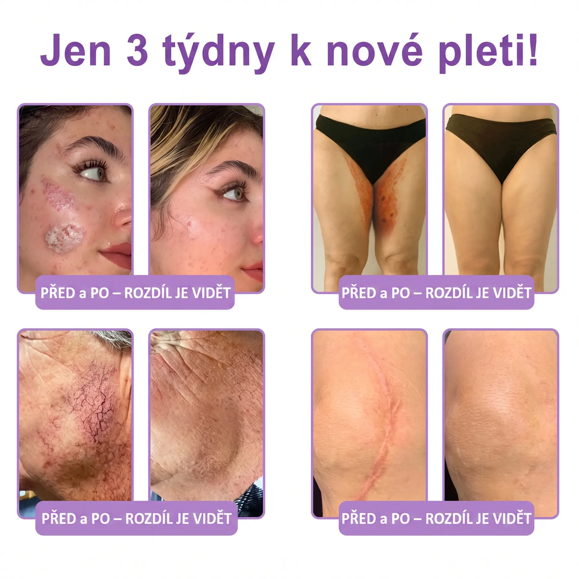 PDRN Multi-Peptide masážní tělový krém s masážním válečkem - Image 7